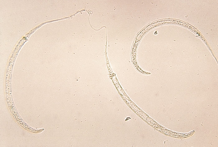 Dracunculus medinensis larvae