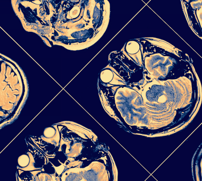 CIVIS New Course “Motor and cognitive systems in neurodegeneration”