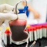 Προκήρυξη ΜΠΣ «Θρόμβωση – Αιμορραγία – Ιατρική των μεταγγίσεων» 2025-2026